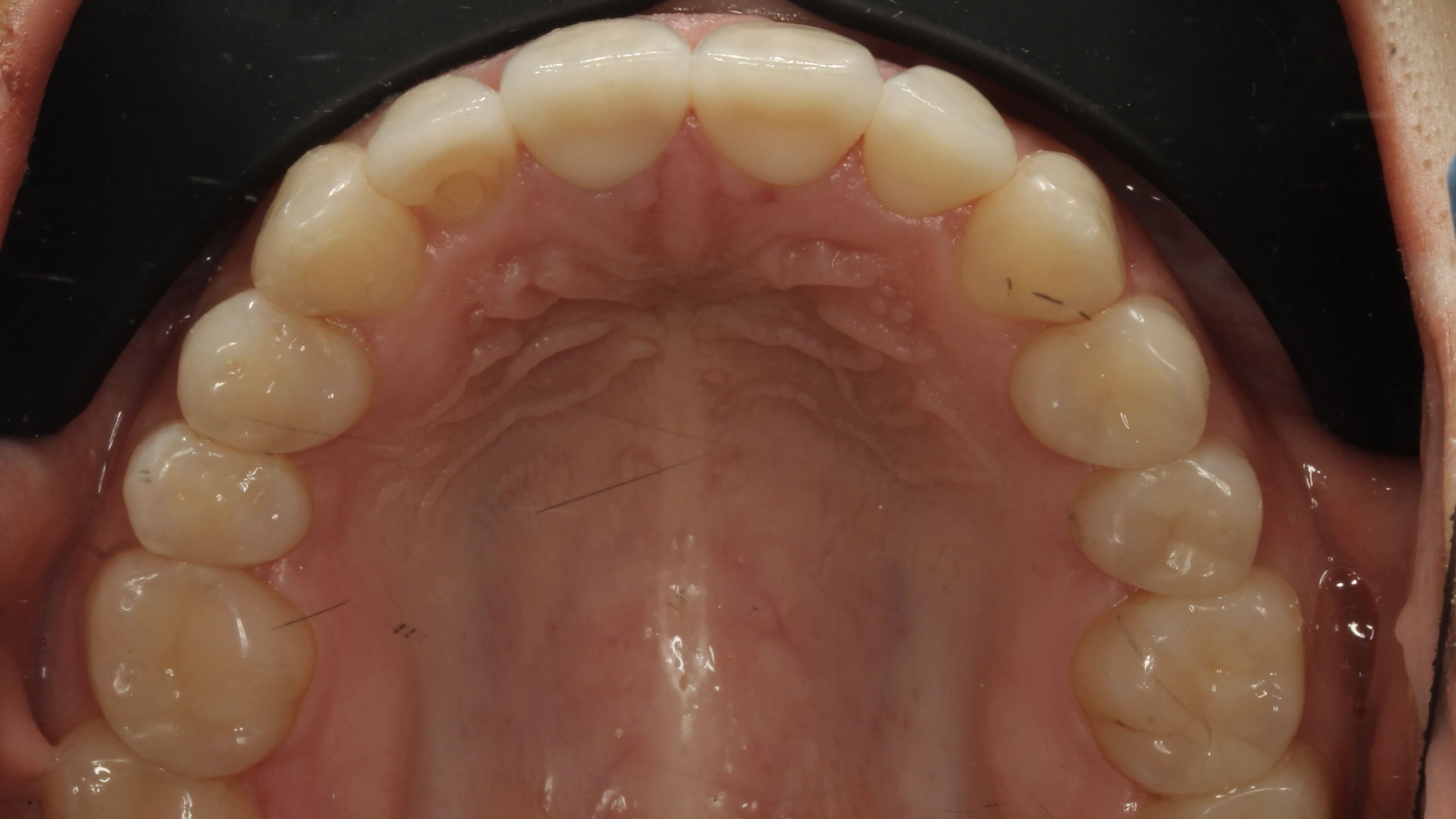 teeth before