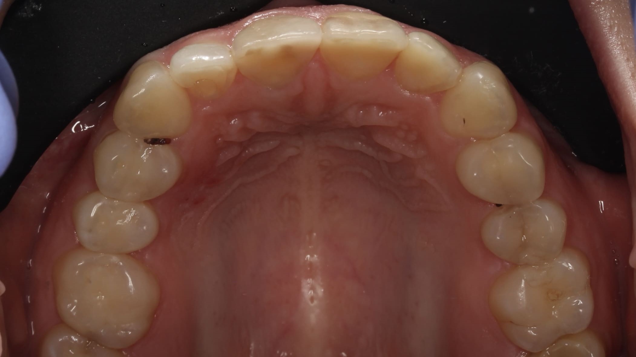 teeth before